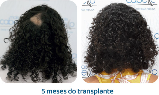 Feminino resultado 1
