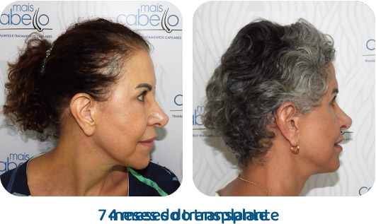 Feminino resultado 4