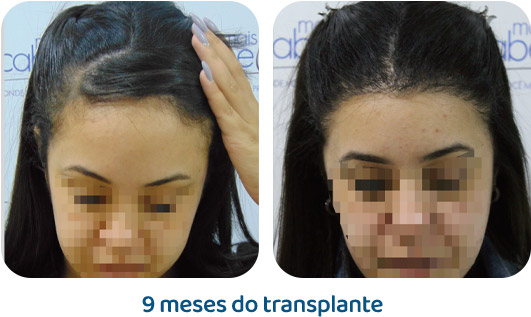 Feminino resultado 5