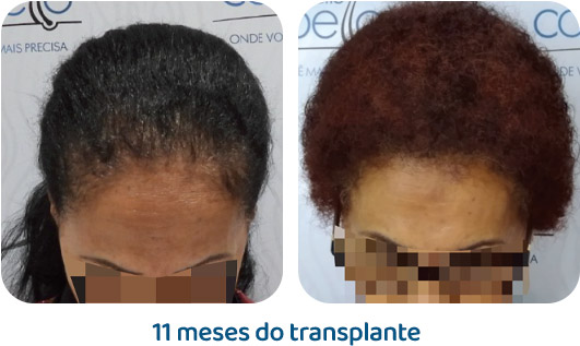 Feminino resultado 8