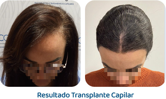 Feminino resultado 9