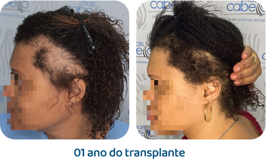 Feminino resultado 10