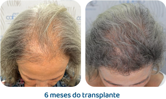 Feminino resultado 11
