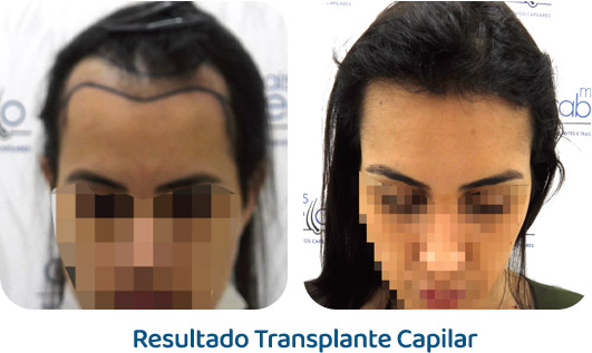 Feminino resultado 12