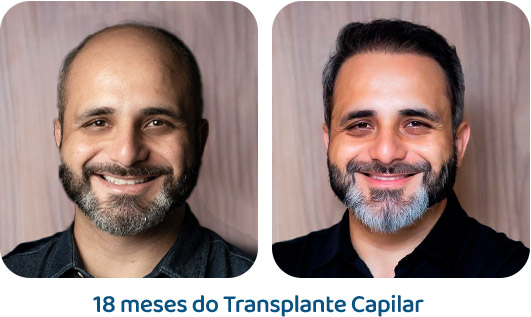 Masculino resultado 1