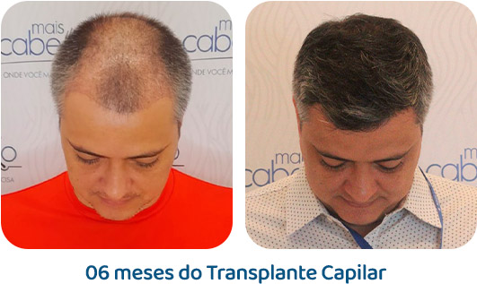 Masculino resultado 2