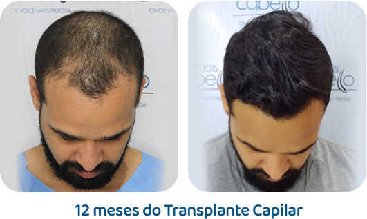 Masculino resultado 3