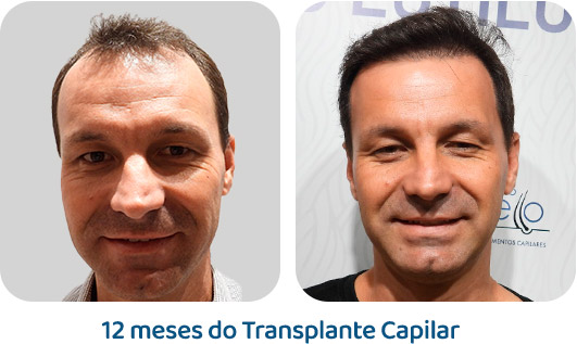 Masculino resultado 4