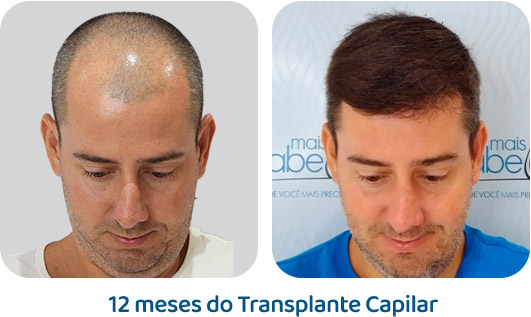 Masculino resultado 6