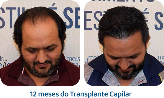 Masculino resultado 8