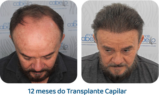 Masculino resultado 9
