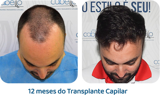 Masculino resultado 100
