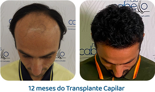 Masculino resultado 101