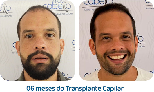 Masculino resultado 103