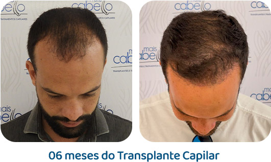 Masculino resultado 104