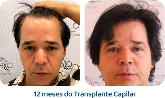 Masculino resultado 105