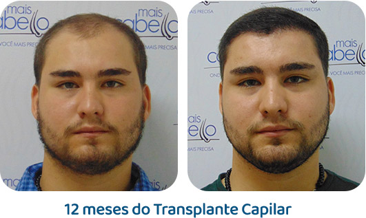 Masculino resultado 106
