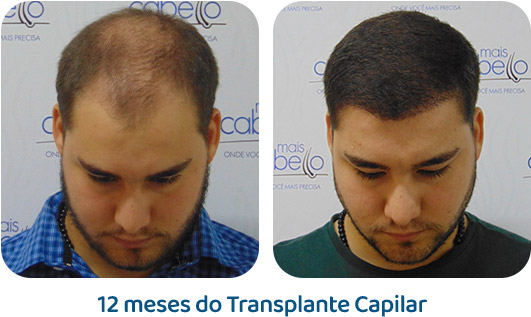 Masculino resultado 107