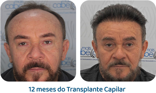Masculino resultado 10