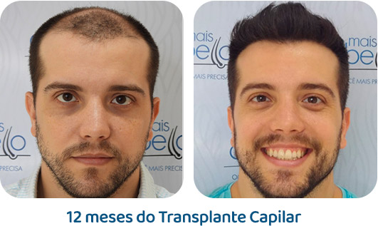 Masculino resultado 109