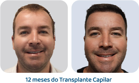 Masculino resultado 113