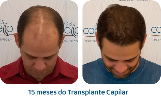 Masculino resultado 115