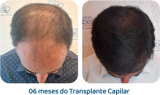 Masculino resultado 116