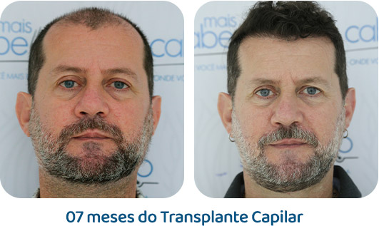 Masculino resultado 118
