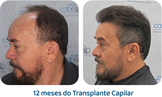 Masculino resultado 11
