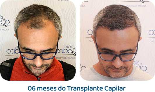 Masculino resultado 119