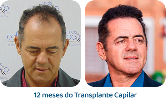 Masculino resultado 120