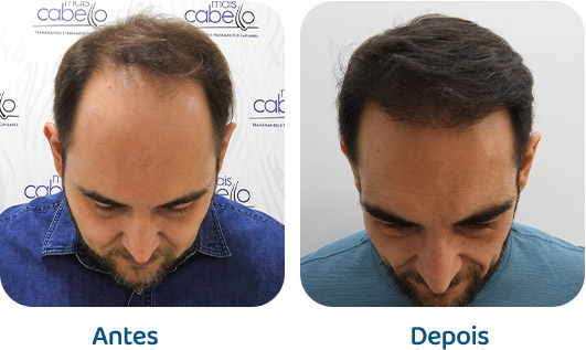 Masculino resultado 121