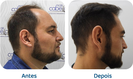 Masculino resultado 122
