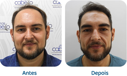 Masculino resultado 123