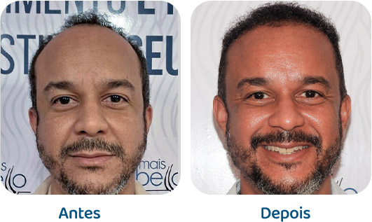 Masculino resultado 124