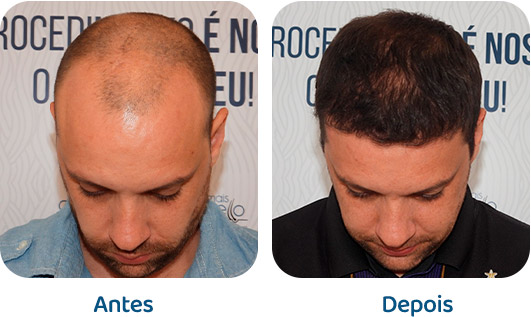 Masculino resultado 125