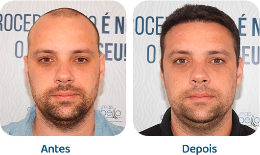 Masculino resultado 126