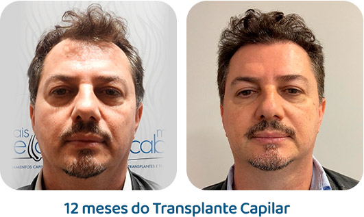Masculino resultado 127