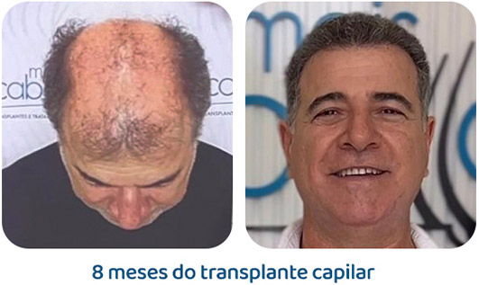 Masculino resultado 130