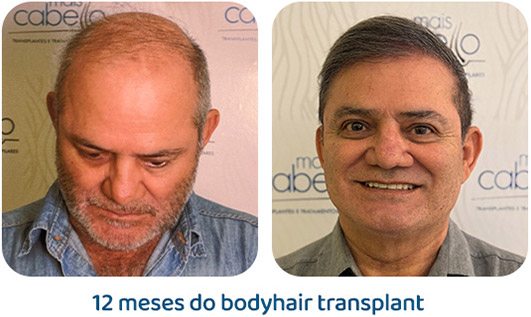 Masculino resultado 131