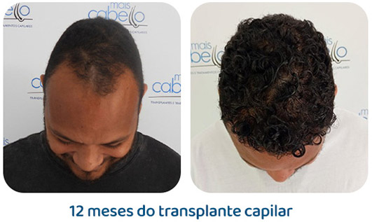 Masculino resultado 133