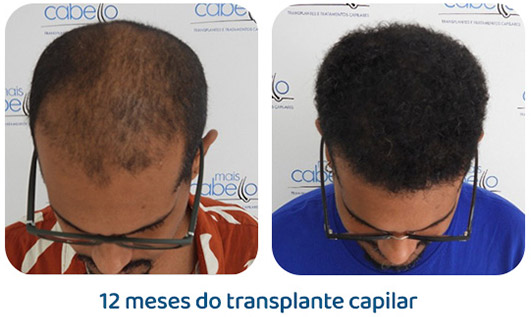 Masculino resultado 134
