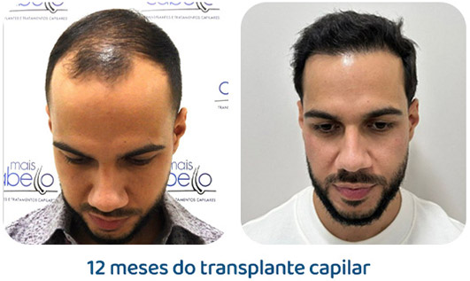 Masculino resultado 135