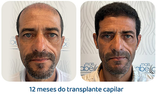 Masculino resultado 136