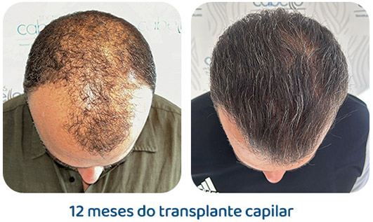 Masculino resultado 137