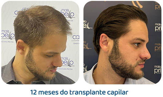 Masculino resultado 138