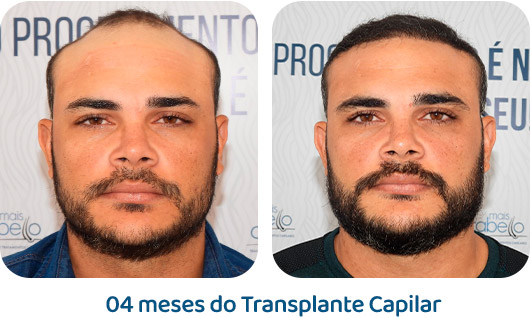 Masculino resultado 13