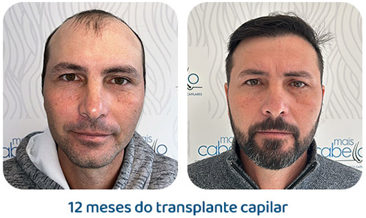 Masculino resultado 139