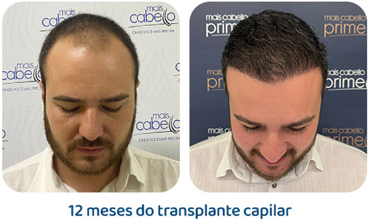 Masculino resultado 141