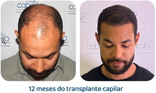 Masculino resultado 142